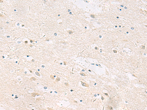Rabbit Polyclonal Antibody to ANKS6