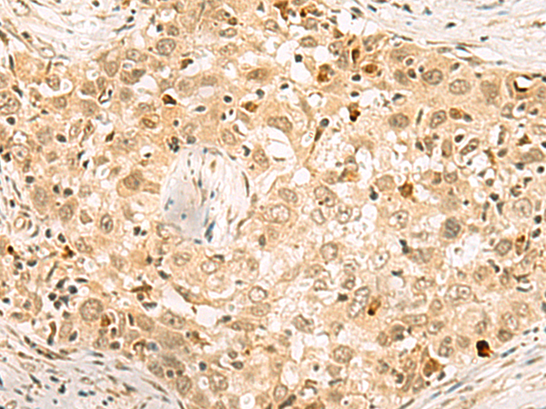 Rabbit Polyclonal Antibody to EXOSC4