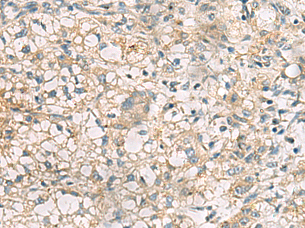 Rabbit Polyclonal Antibody to RTP4