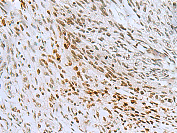 Rabbit Polyclonal Antibody to CNOT7