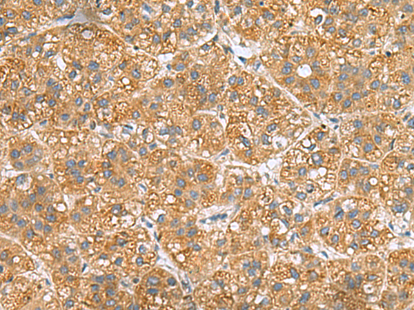 Rabbit Polyclonal Antibody to PPM1M