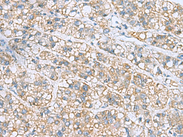 Rabbit Polyclonal Antibody to NANP