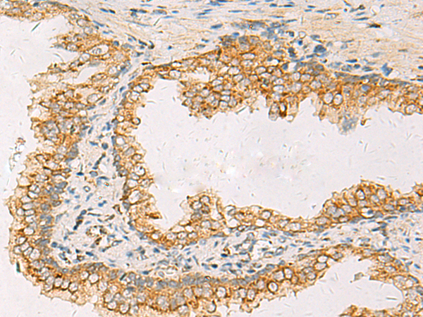 Rabbit Polyclonal Antibody to SUSD3
