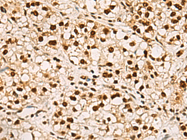Rabbit Polyclonal Antibody to ELF5