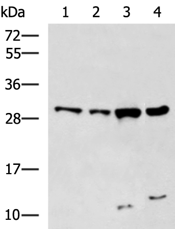 Rabbit Polyclonal Antibody to KCNIP3