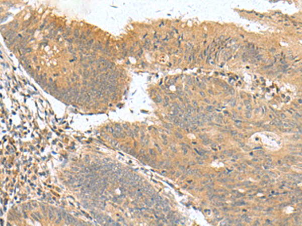 Rabbit Polyclonal Antibody to HHIPL2