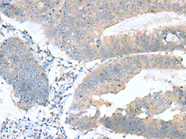 Rabbit Polyclonal Antibody to KRCC1