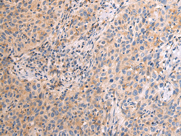 Rabbit Polyclonal Antibody to KCTD4