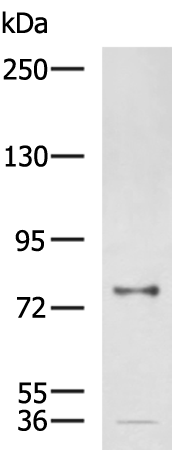 Rabbit Polyclonal Antibody to CNST