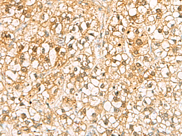 Rabbit Polyclonal Antibody to C11orf54