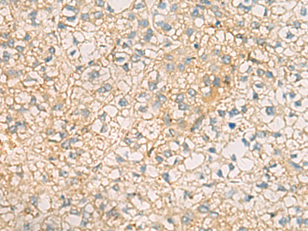 Rabbit Polyclonal Antibody to MRPL9