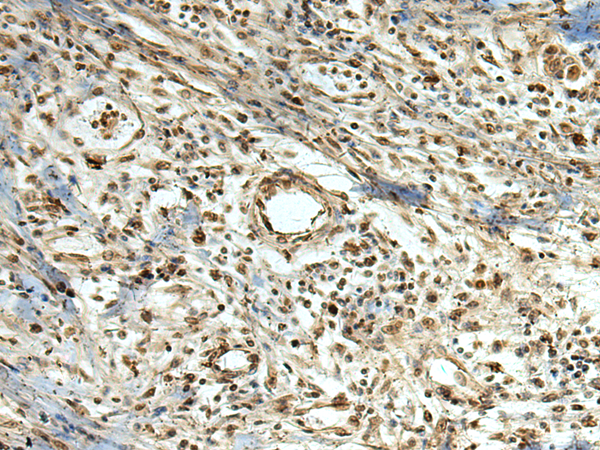 Rabbit Polyclonal Antibody to MLF1