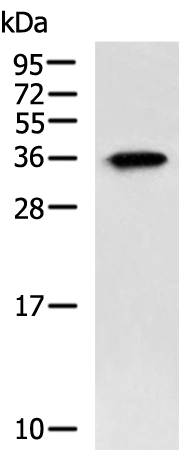 Rabbit Polyclonal Antibody to SPACA1