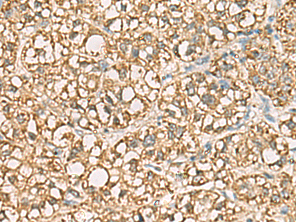 Rabbit Polyclonal Antibody to VTA1