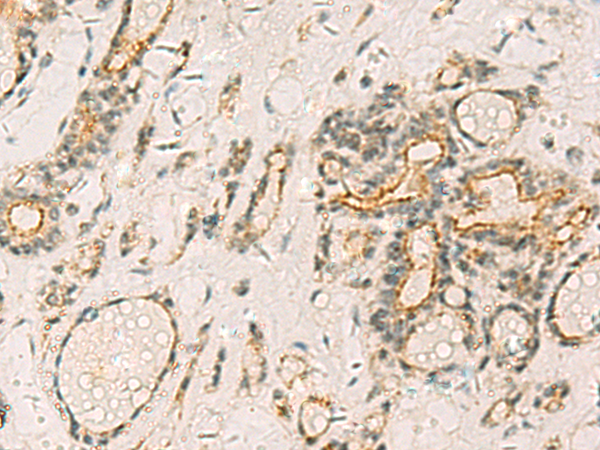 Rabbit Polyclonal Antibody to HORMAD2