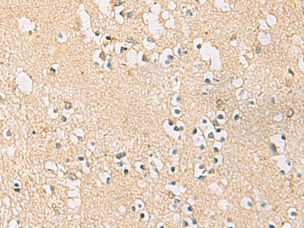 Rabbit Polyclonal Antibody to PDE4DIP