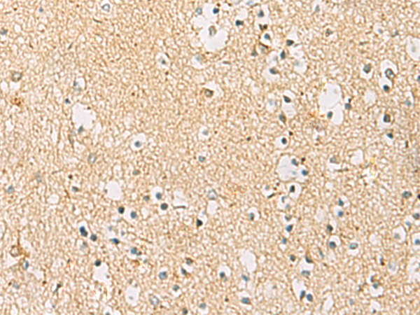 Rabbit Polyclonal Antibody to IDS