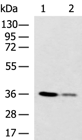 Rabbit Polyclonal Antibody to PDXK