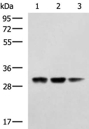 Rabbit Polyclonal Antibody to MGLL