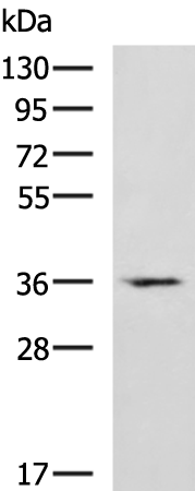 Rabbit Polyclonal Antibody to CRYM