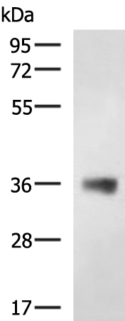 Rabbit Polyclonal Antibody to EPCAM