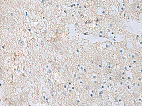 Rabbit Polyclonal Antibody to RDH5