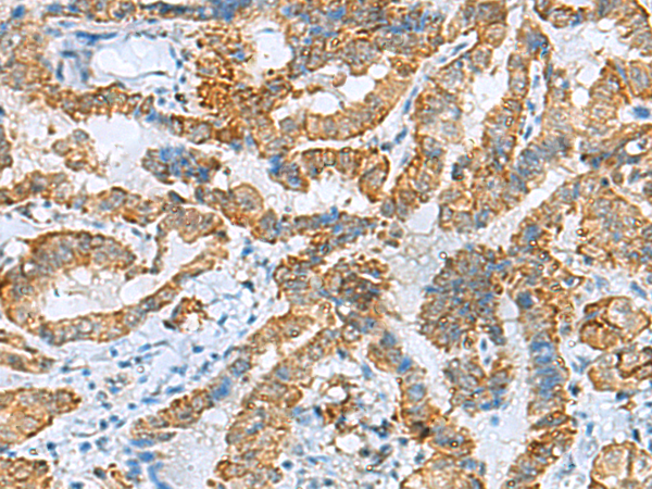 Rabbit Polyclonal Antibody to FBXO8