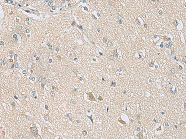 Rabbit Polyclonal Antibody to TSTA3
