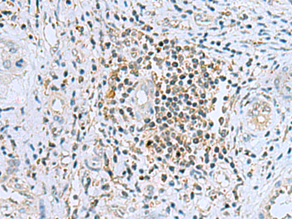 Rabbit Polyclonal Antibody to DHRS7B