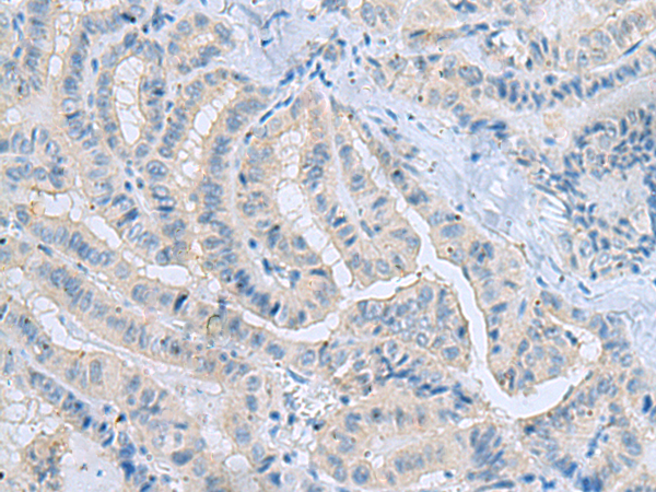 Rabbit Polyclonal Antibody to MSI2