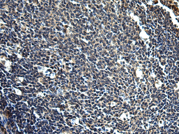 Rabbit Polyclonal Antibody to PRRT2
