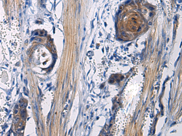Rabbit Polyclonal Antibody to ICA1