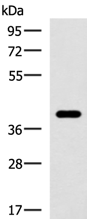 Rabbit Polyclonal Antibody to GALM