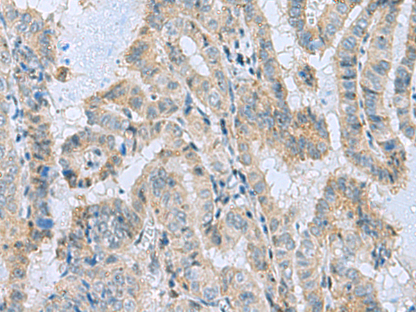 Rabbit Polyclonal Antibody to MGME1
