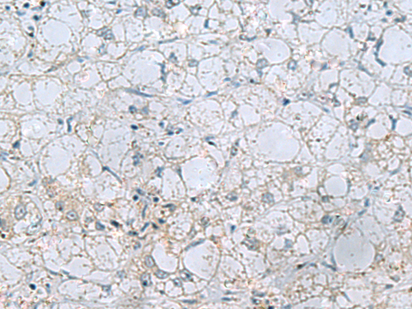 Rabbit Polyclonal Antibody to NAGK