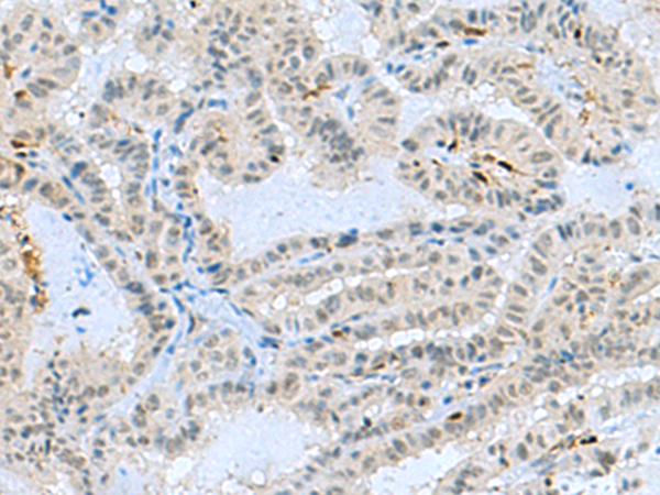 Rabbit Polyclonal Antibody to TCF19