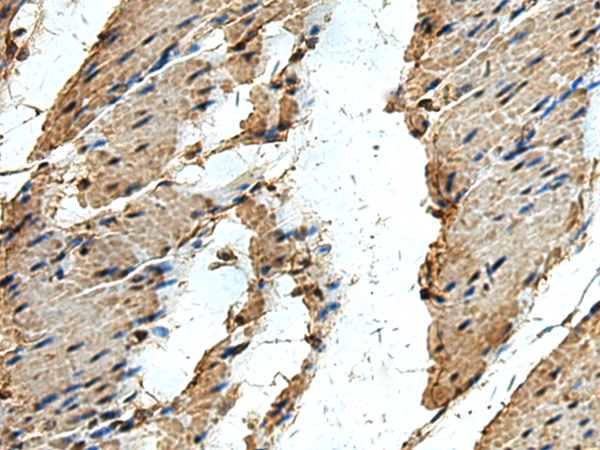 Rabbit Polyclonal Antibody to ERLIN1