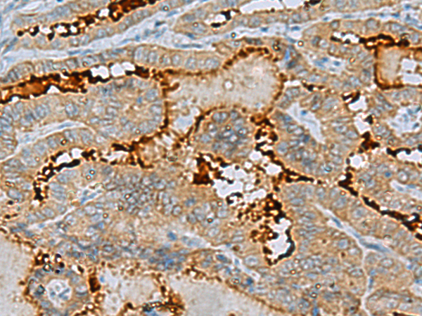 Rabbit Polyclonal Antibody to ENKD1