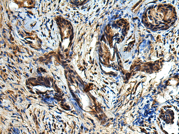 Rabbit Polyclonal Antibody to TBCC
