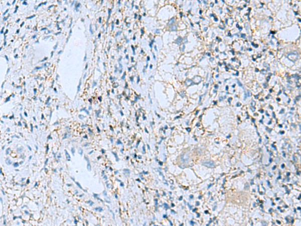 Rabbit Polyclonal Antibody to EMILIN1