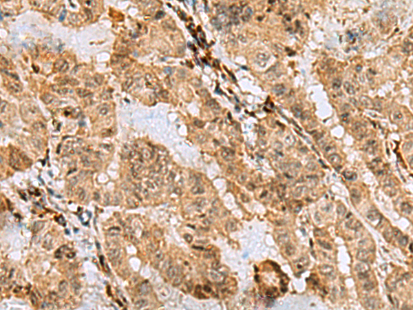 Rabbit Polyclonal Antibody to GET3