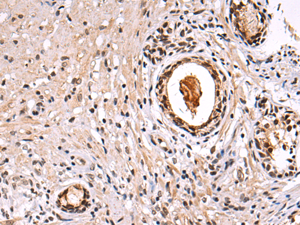 Rabbit Polyclonal Antibody to HEATR1