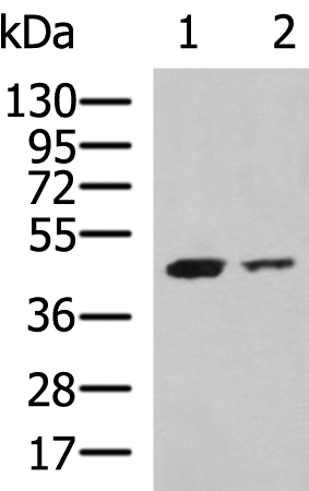 Rabbit Polyclonal Antibody to SUV39H2