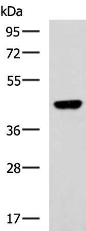 Rabbit Polyclonal Antibody to GNAI1