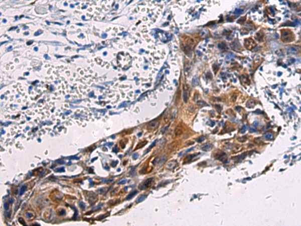 Rabbit Polyclonal Antibody to SORD