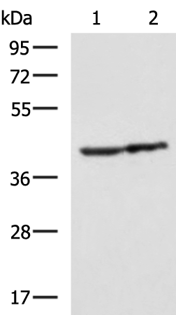 Rabbit Polyclonal Antibody to TMOD1