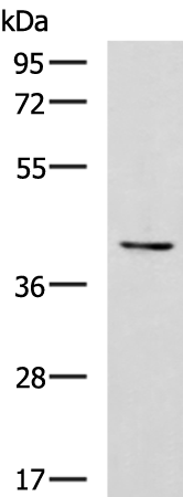 Rabbit Polyclonal Antibody to RAD23A