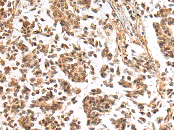 Rabbit Polyclonal Antibody to NHLRC2