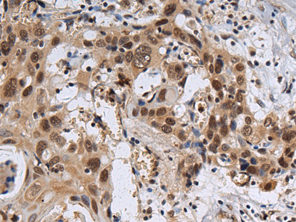 Rabbit Polyclonal Antibody to ZNF821