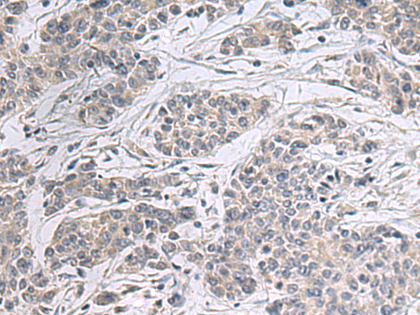 Rabbit Polyclonal Antibody to PPM1K